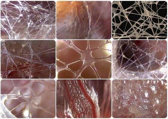 LES FASCIAS : LE RÉSEAU CACHÉ QUI RÉGULE NOS TENSIONS -  ET POURQUOI ILS DOIVENT ÊTRE PURGÉS RÉGULIÈREMENT.